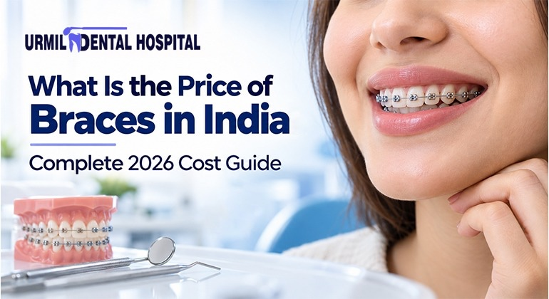 What Is the Price of Braces in India
